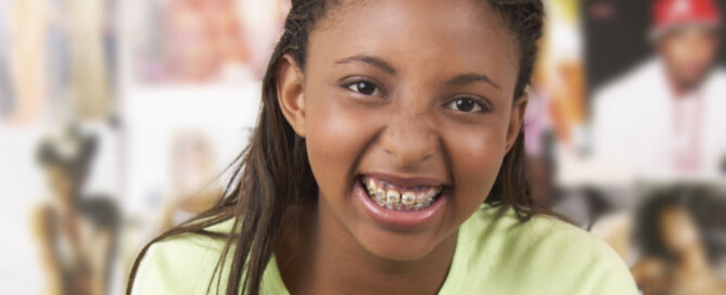 5 Types Of Food To Avoid After Getting Braces